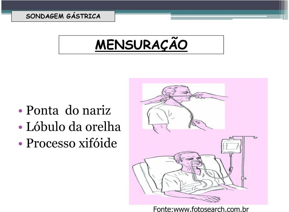 Lóbulo da orelha Processo