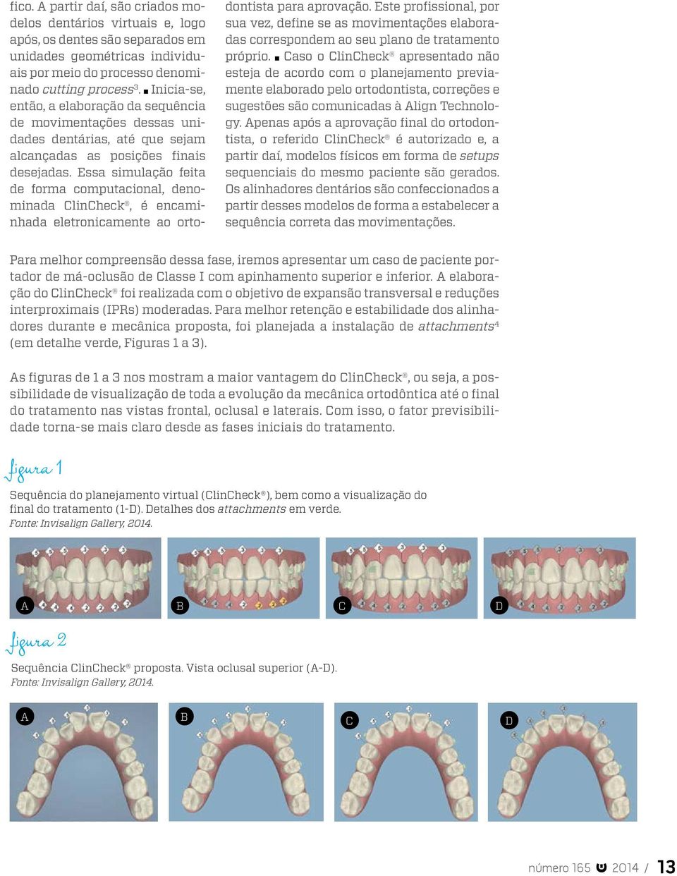 Essa simulação feita de forma computacional, denominada ClinCheck, é encaminhada eletronicamente ao ortodontista para aprovação.