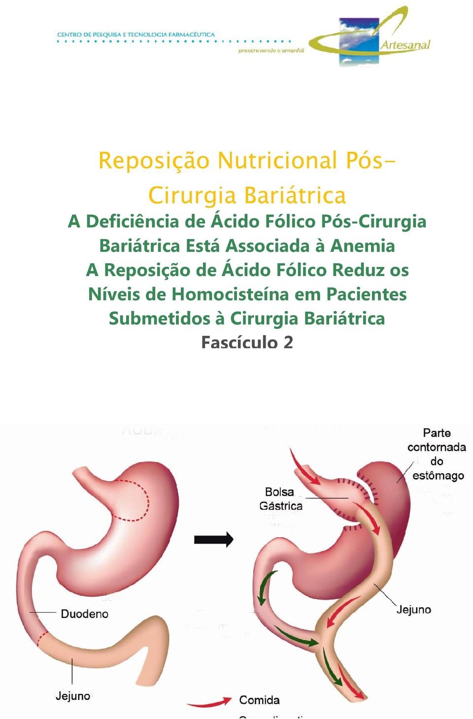 Anemia A Reposição de Ácido Fólico Reduz os Níveis de