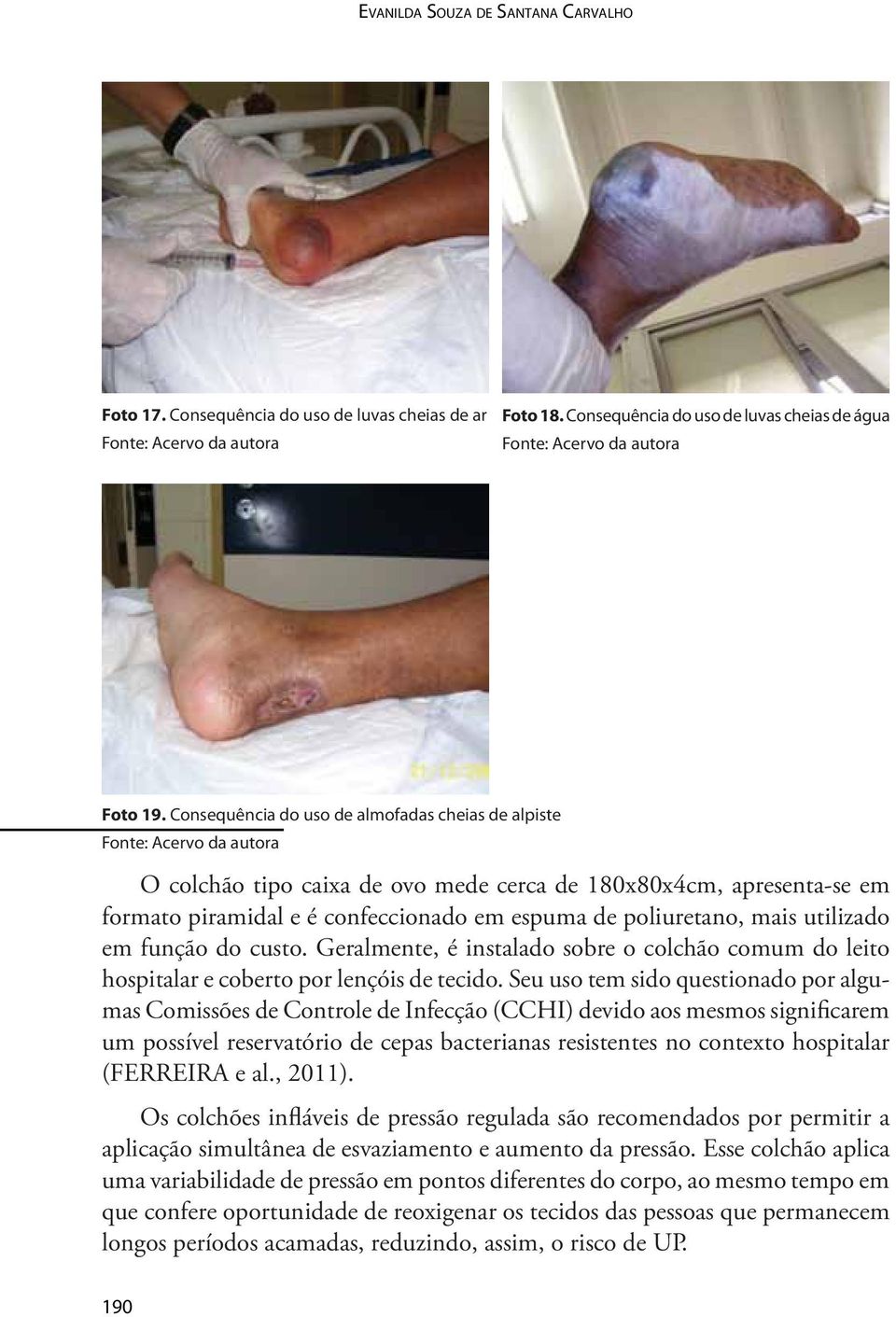 em função do custo. Geralmente, é instalado sobre o colchão comum do leito hospitalar e coberto por lençóis de tecido.