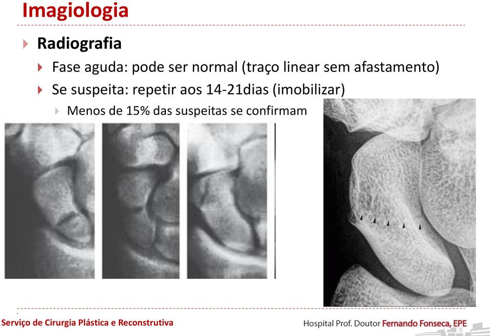 Se suspeita: repetir aos 14-21dias