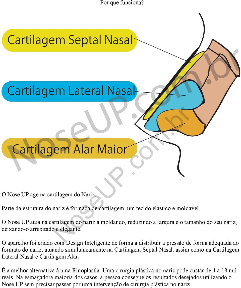 O aparelho foi criado com Design Inteligente de forma a distribuir a pressão de forma adequada ao formato do nariz, atuando simultaneamente na Cartilagem Septal Nasal, assim como na