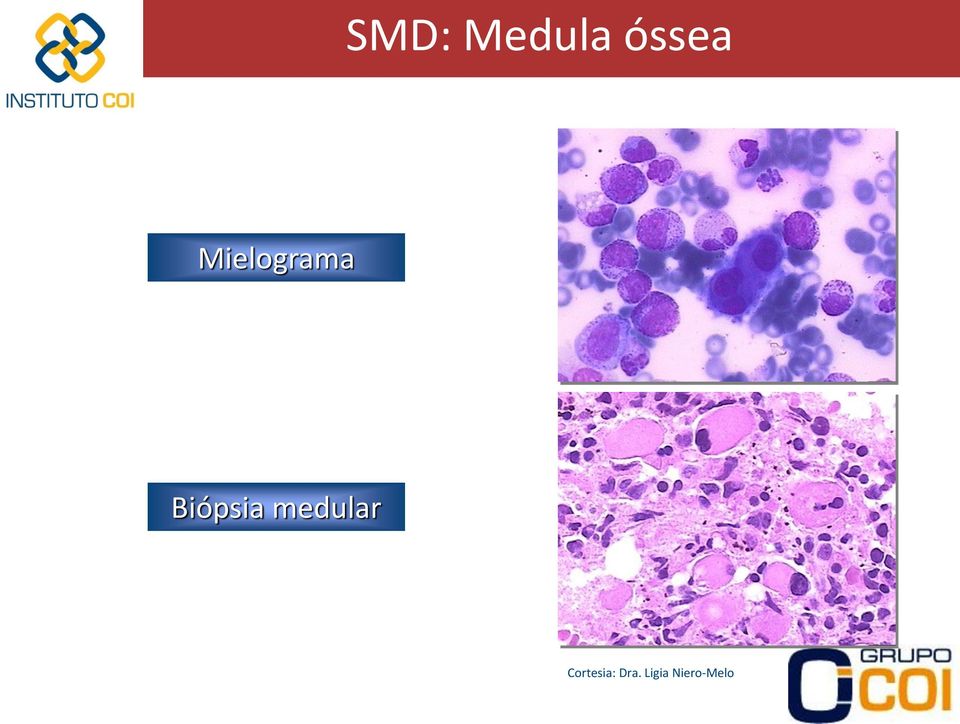 medular Cortesia: