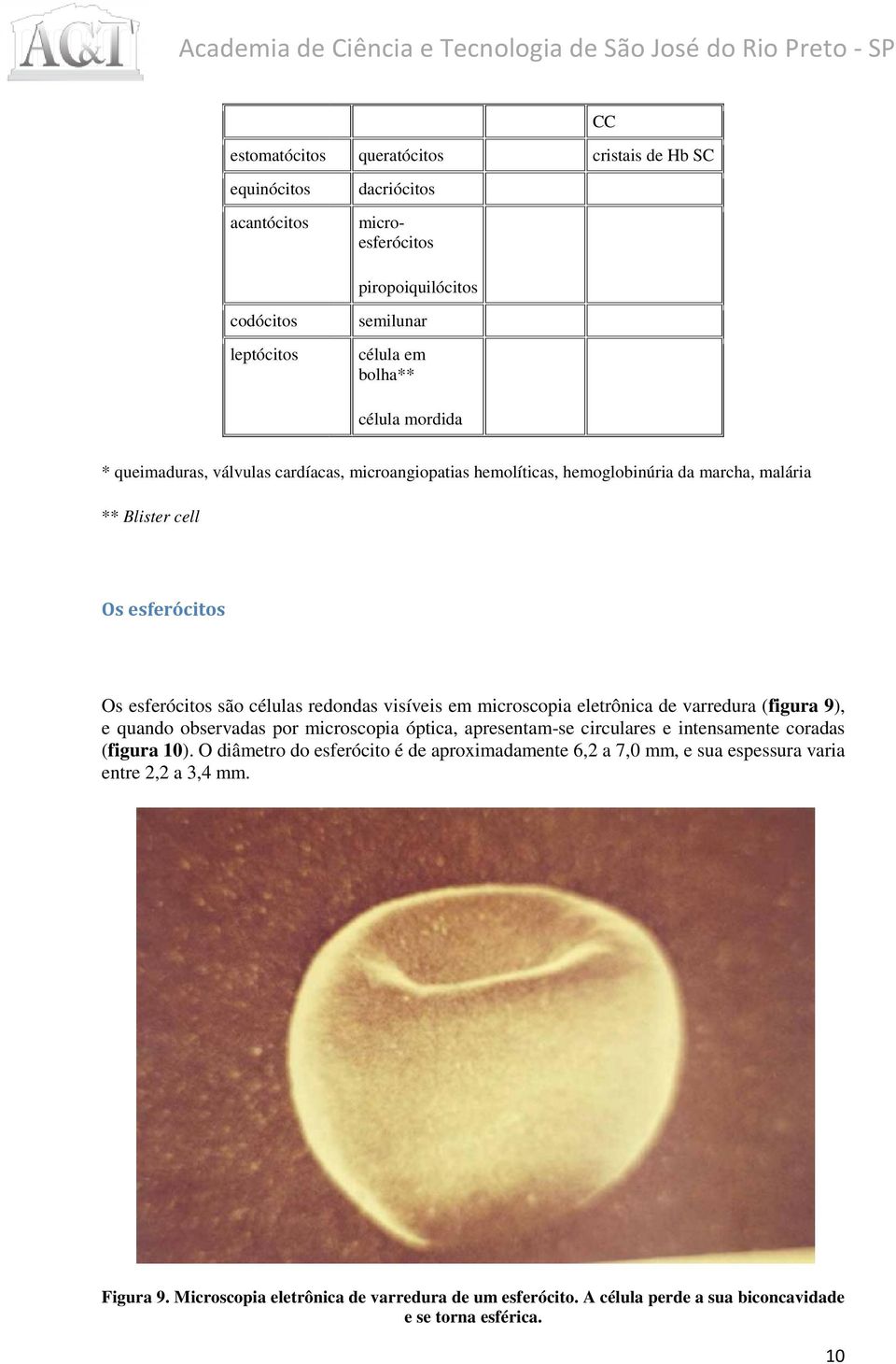 microscopia eletrônica de varredura (figura 9), e quando observadas por microscopia óptica, apresentam-se circulares e intensamente coradas (figura 10).