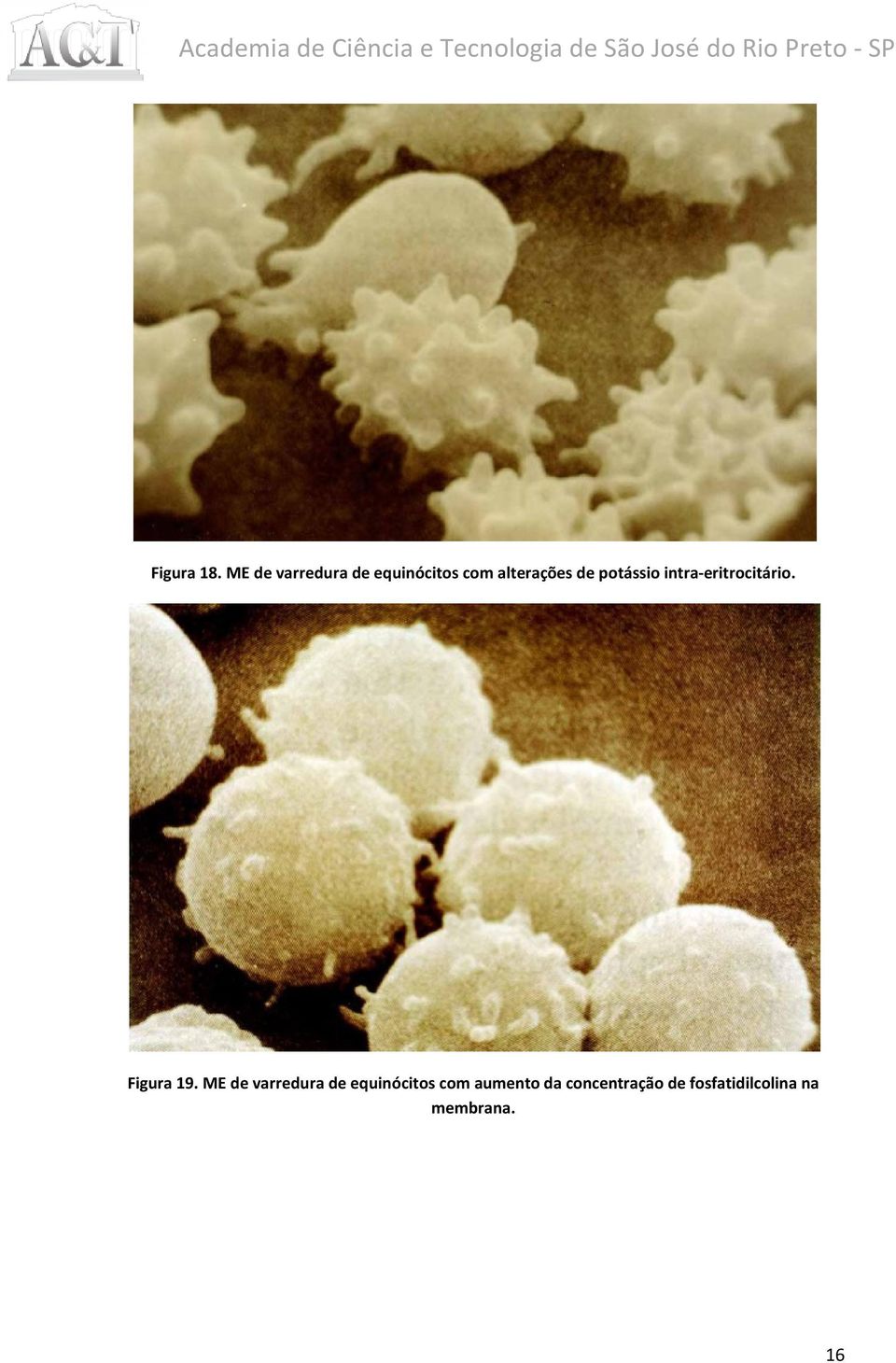 potássio intra-eritrocitário. Figura 19.