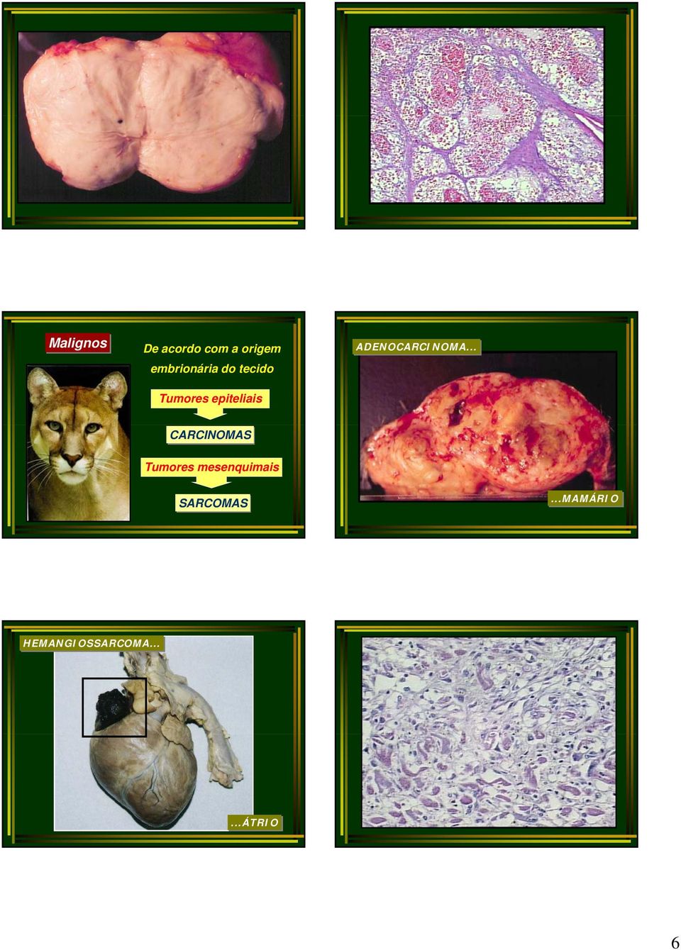 ADENOCARCINOMA.