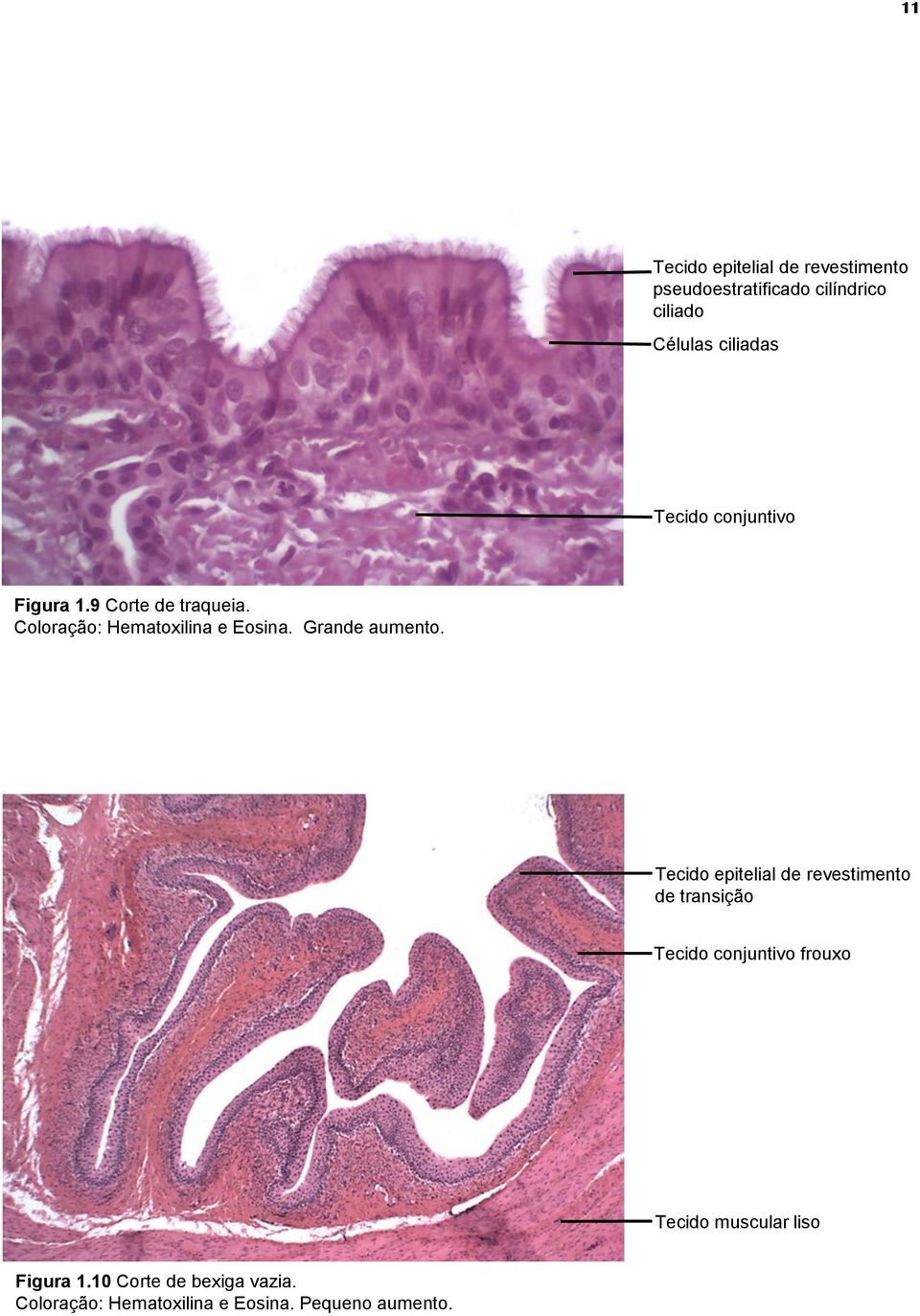Tecido epitelial de revestimento de transição Tecido conjuntivo frouxo Tecido