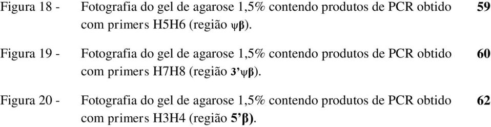 Fotografia do gel de agarose 1,5% contendo produtos de PCR obtido com primers H7H8