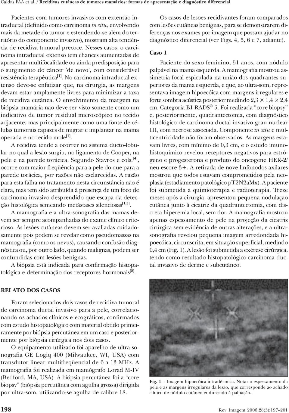 da metade do tumor e estendendo-se além do território do componente invasivo), mostram alta tendência de recidiva tumoral precoce.