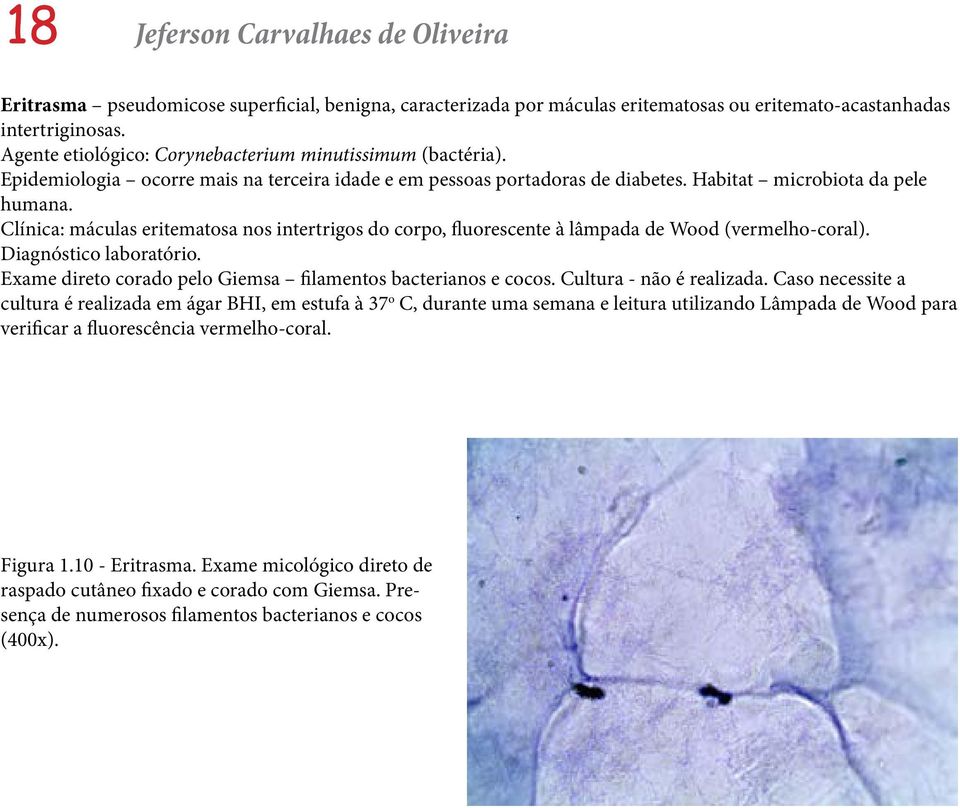 Clínica: máculas eritematosa nos intertrigos do corpo, fluorescente à lâmpada de Wood (vermelho-coral). Diagnóstico laboratório. Exame direto corado pelo Giemsa filamentos bacterianos e cocos.