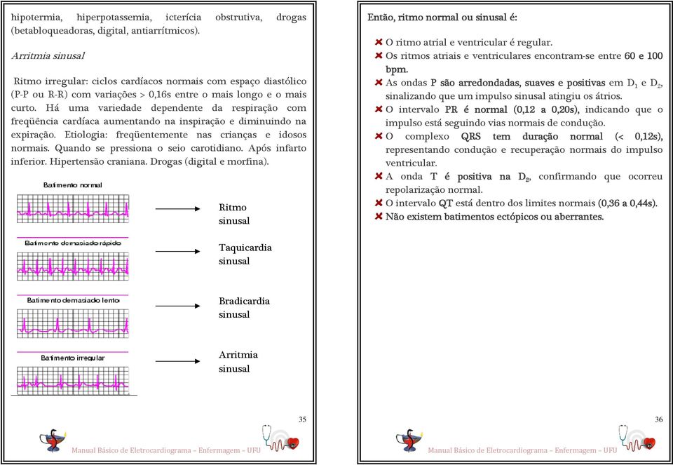 Há uma variedade dependente da respiração com freqüência cardíaca aumentando na inspiração e diminuindo na expiração. Etiologia: freqüentemente nas crianças e idosos normais.