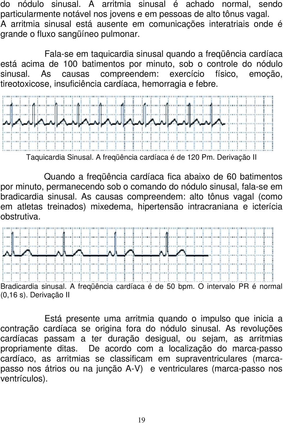 Fala-se em taquicardia sinusal quando a freqüência cardíaca está acima de 100 batimentos por minuto, sob o controle do nódulo sinusal.