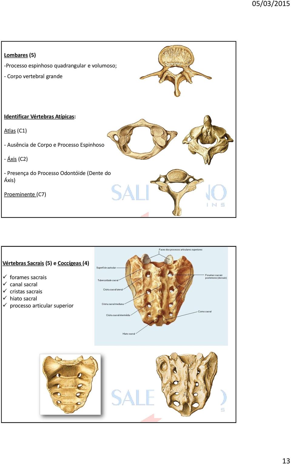 (C2) - Presença do Processo Odontóide (Dente do Áxis) Proeminente (C7) Vértebras Sacrais (5)