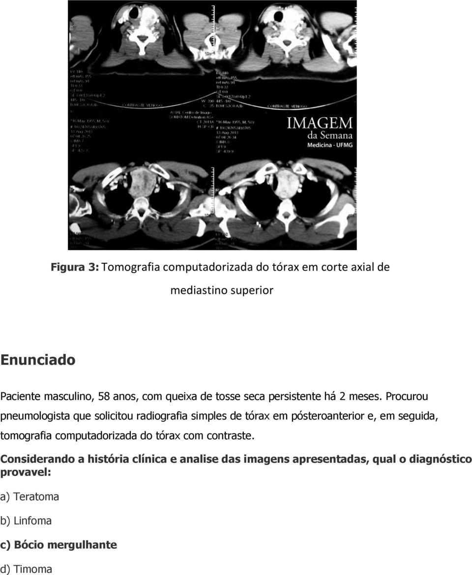 Procurou pneumologista que solicitou radiografia simples de tórax em pósteroanterior e, em seguida, tomografia