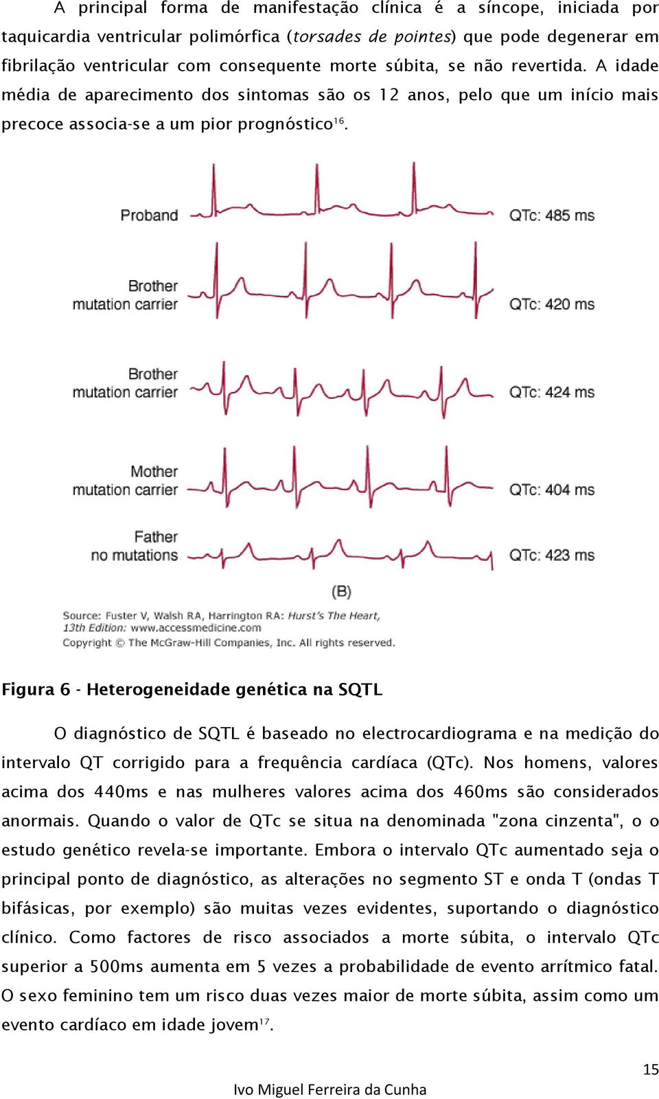 Figura 6 - Heterogeneidade genética na SQTL O diagnóstico de SQTL é baseado no electrocardiograma e na medição do intervalo QT corrigido para a frequência cardíaca (QTc).