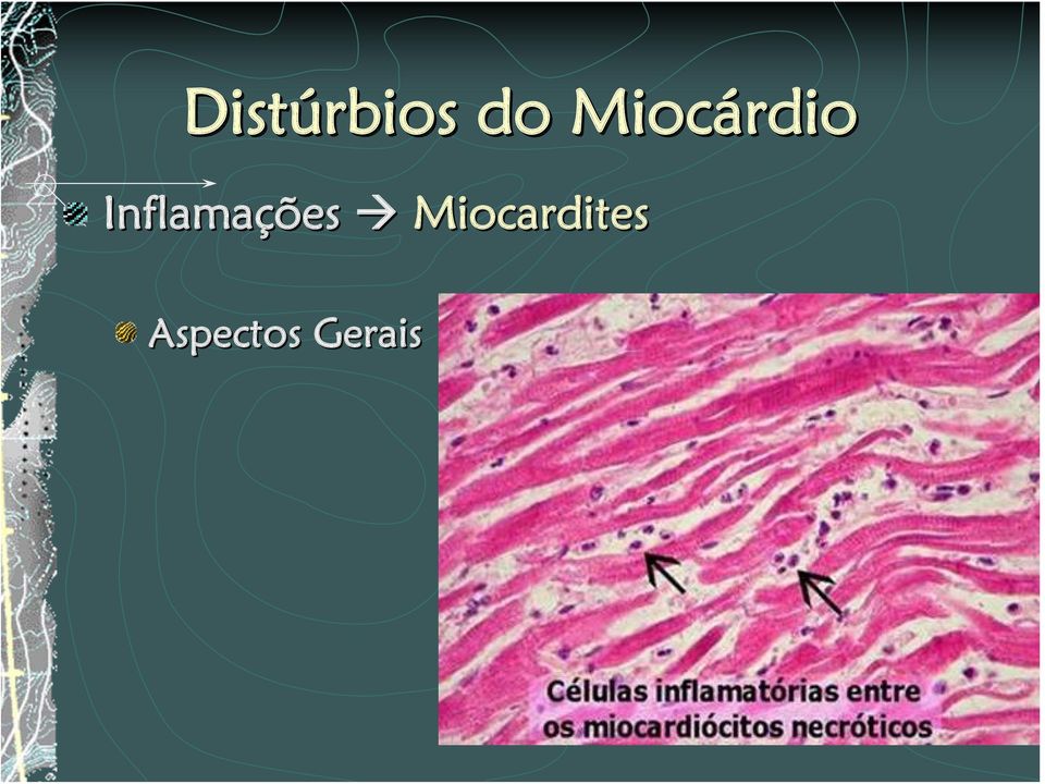 Inflamações