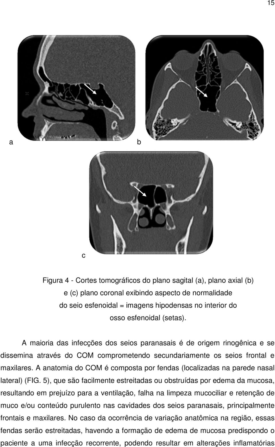 A anatomia do COM é composta por fendas (localizadas na parede nasal lateral) (FIG.