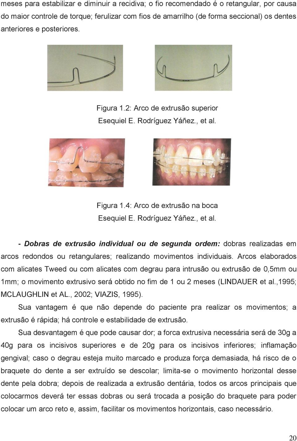 Figura 1.4: Arco de extrusão na boca Esequiel E. Rodríguez Yáñez., et al.
