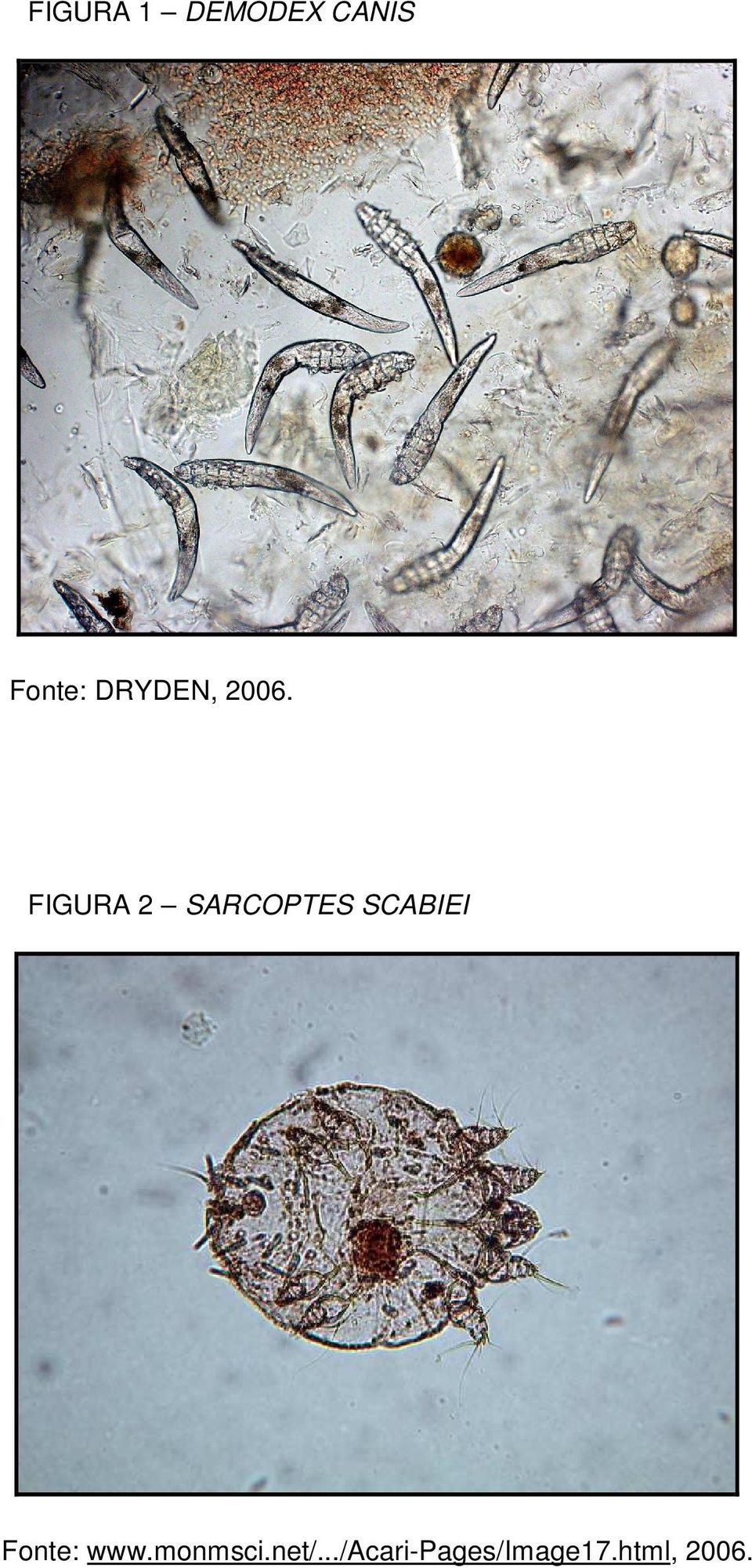 FIGURA 2 SARCOPTES SCABIEI