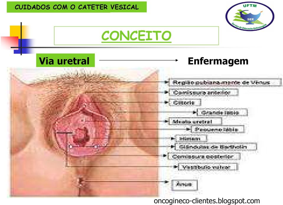 Enfermagem