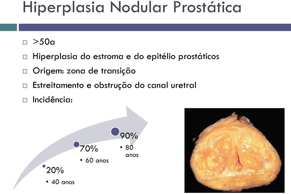 transição Estreitamento e obstrução do canal