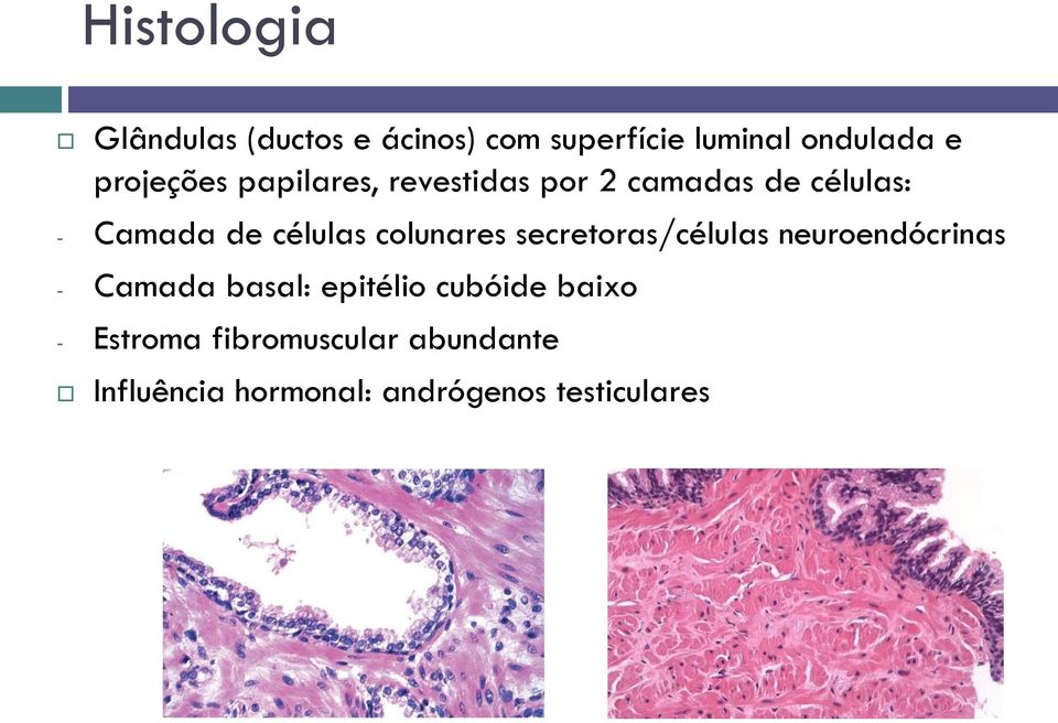 colunares secretoras/células neuroendócrinas - Camada basal: epitélio cubóide