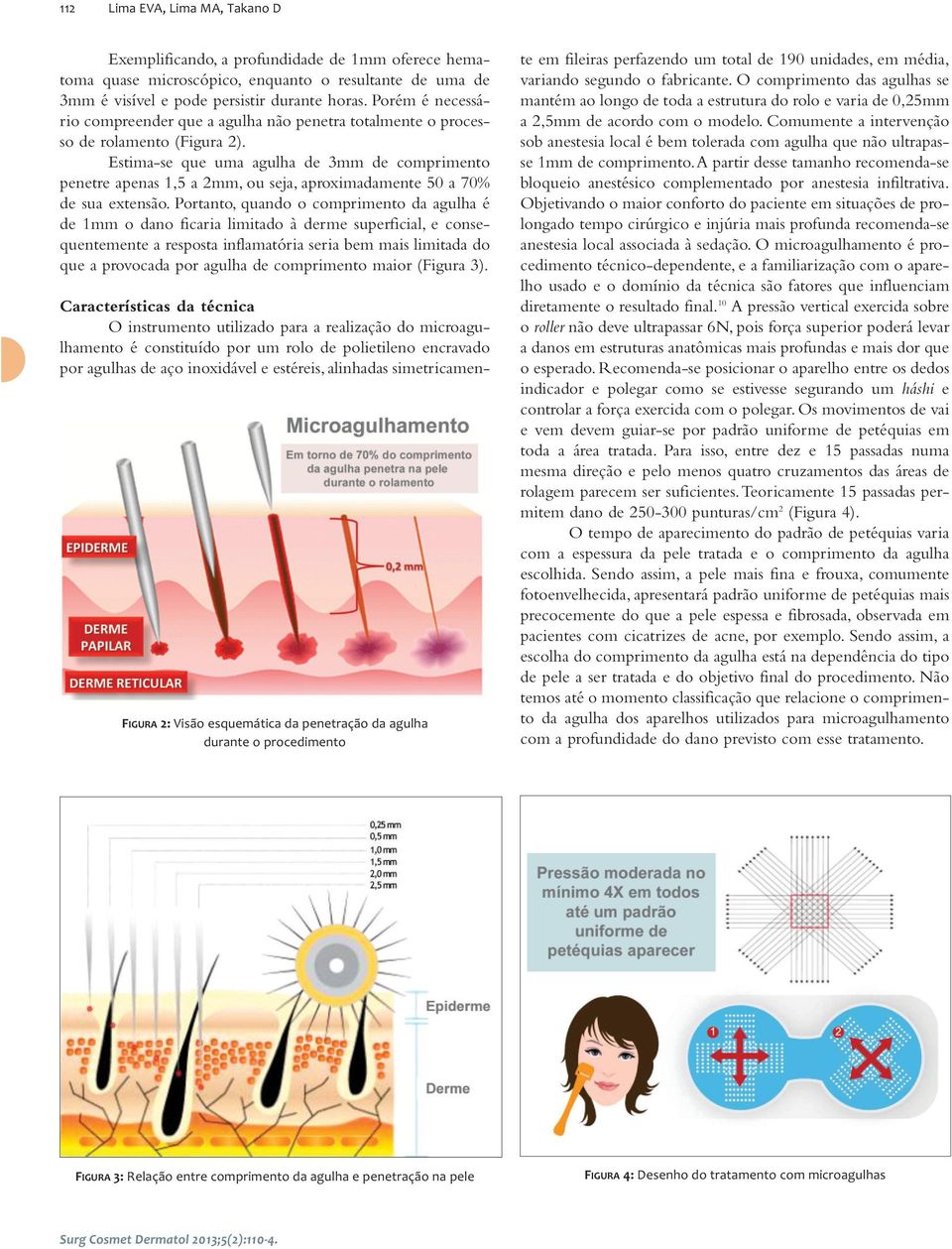 Estima-se que uma agulha de 3mm de comprimento penetre apenas 1,5 a 2mm, ou seja, aproximadamente 50 a 70% de sua extensão.