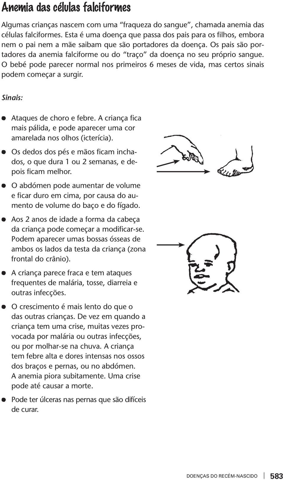 Os pais são portadores da anemia falciforme ou do traço da doença no seu próprio sangue. O bebé pode parecer normal nos primeiros 6 meses de ida, mas certos sinais podem começar a surgir.