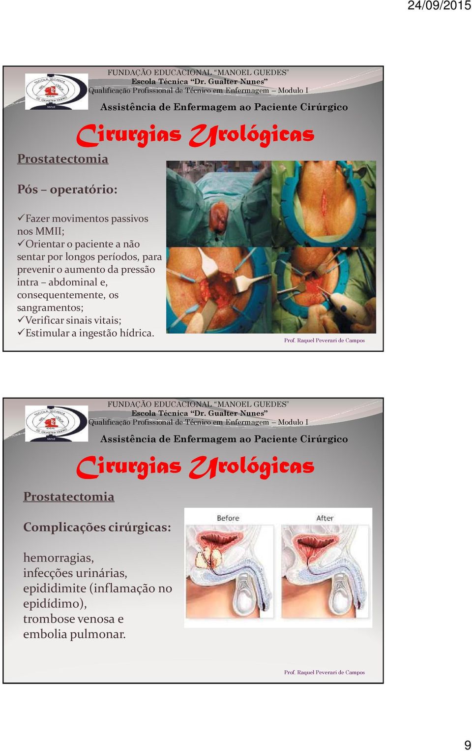 sangramentos; Verificar sinais vitais; Estimular a ingestão hídrica.