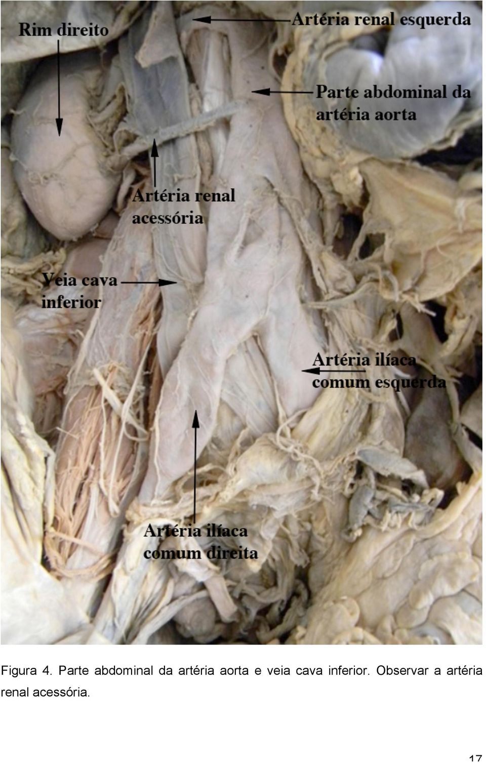 artéria aorta e veia cava