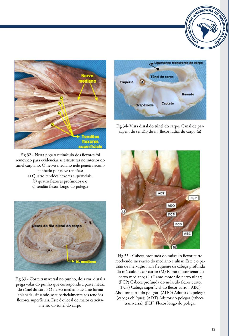 O nervo mediano nele penetra acompanhado por nove tendões: a) Quatro tendões flexores superficiais, b) quatro flexores profundos e o c) tendão flexor longo do polegar Fig.