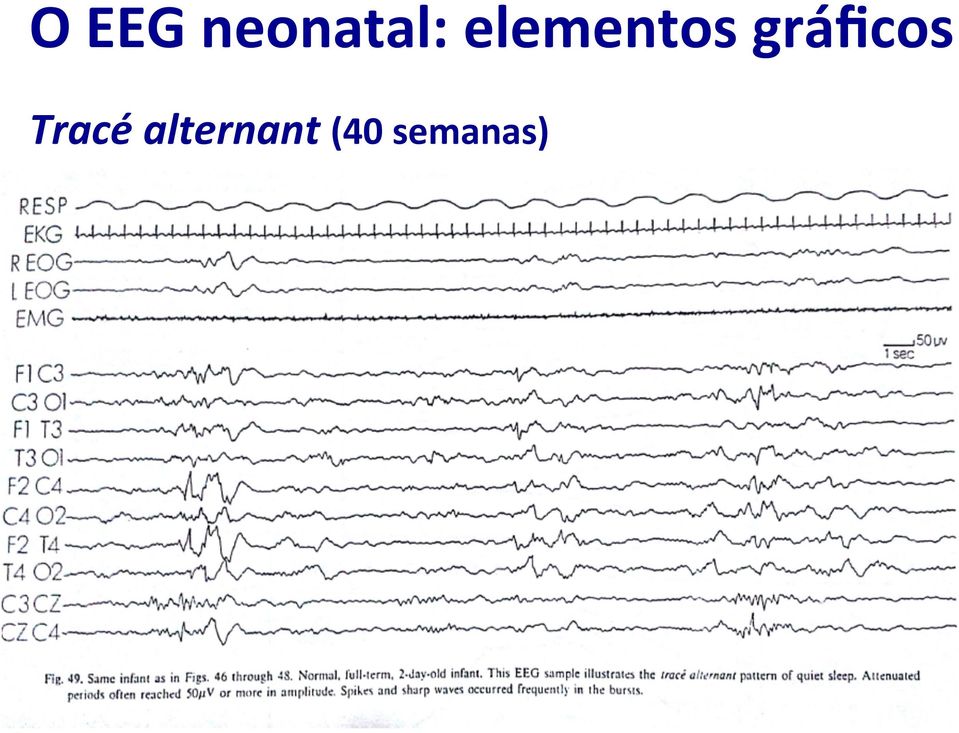 gráficos Tracé