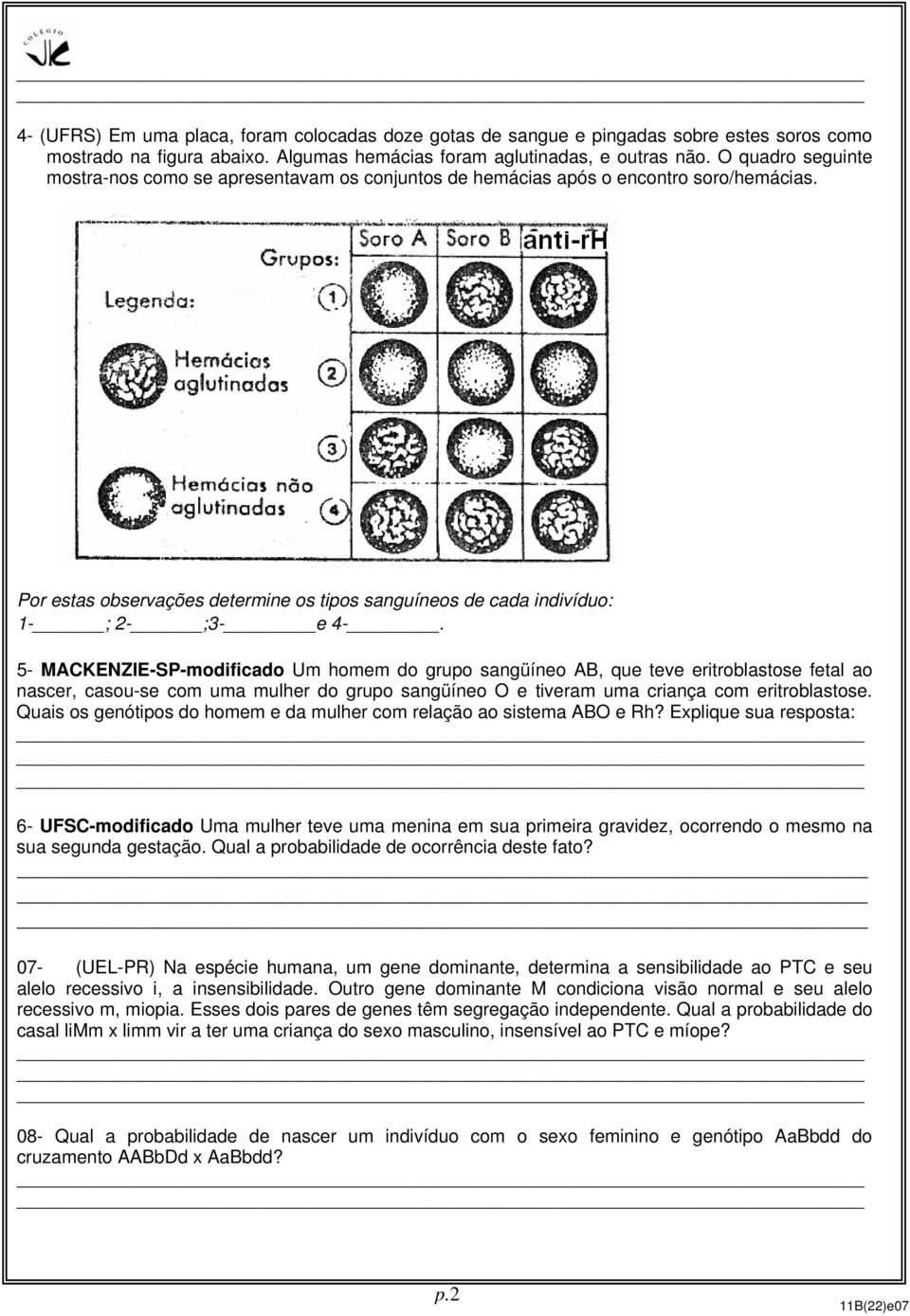 5- MACKENZIE-SP-modificado Um homem do grupo sangüíneo AB, que teve eritroblastose fetal ao nascer, casou-se com uma mulher do grupo sangüíneo O e tiveram uma criança com eritroblastose.