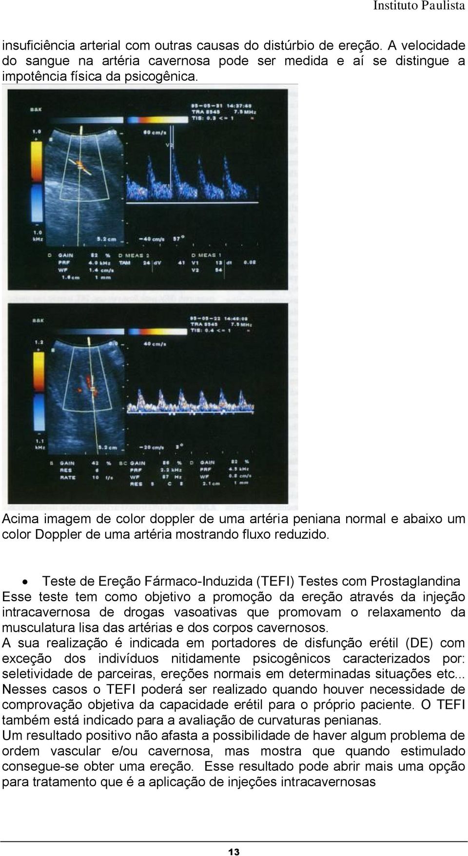 Teste de Ereção Fármaco-Induzida (TEFI) Testes com Prostaglandina Esse teste tem como objetivo a promoção da ereção através da injeção intracavernosa de drogas vasoativas que promovam o relaxamento