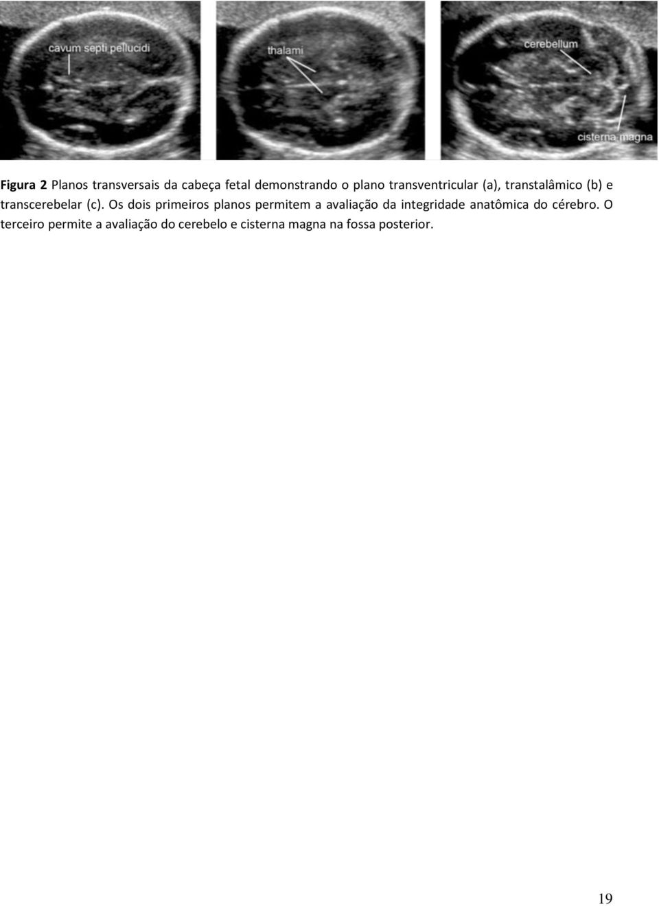 Os dois primeiros planos permitem a avaliação da integridade anatômica do