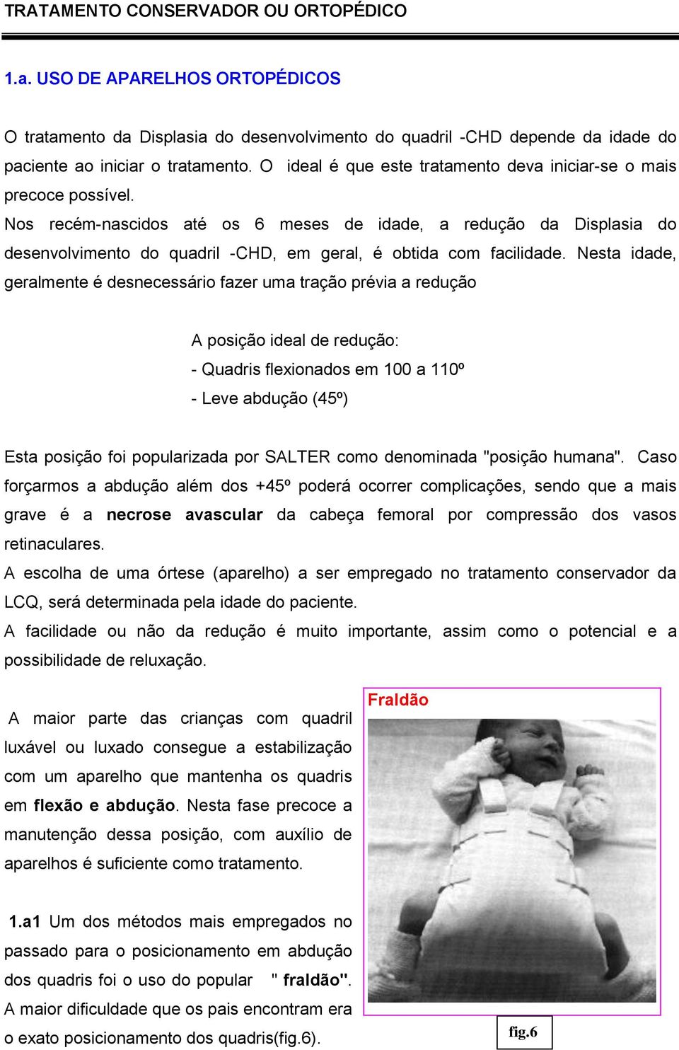 Nos recém-nascidos até os 6 meses de idade, a redução da Displasia do desenvolvimento do quadril -CHD, em geral, é obtida com facilidade.