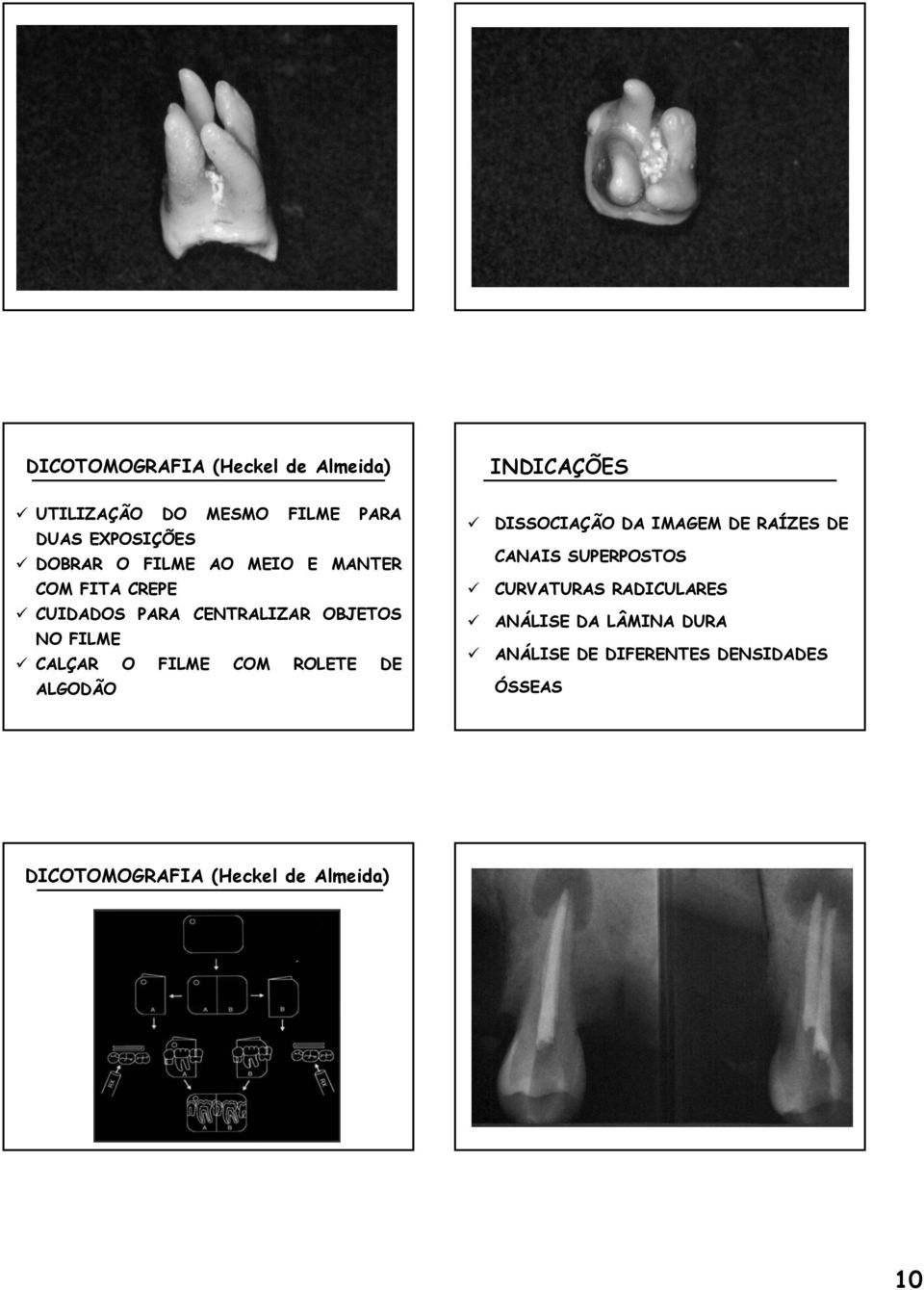 COM ROLETE DE ALGODÃO DISSOCIAÇÃO DA IMAGEM DE RAÍZES DE CANAIS SUPERPOSTOS CURVATURAS RADICULARES