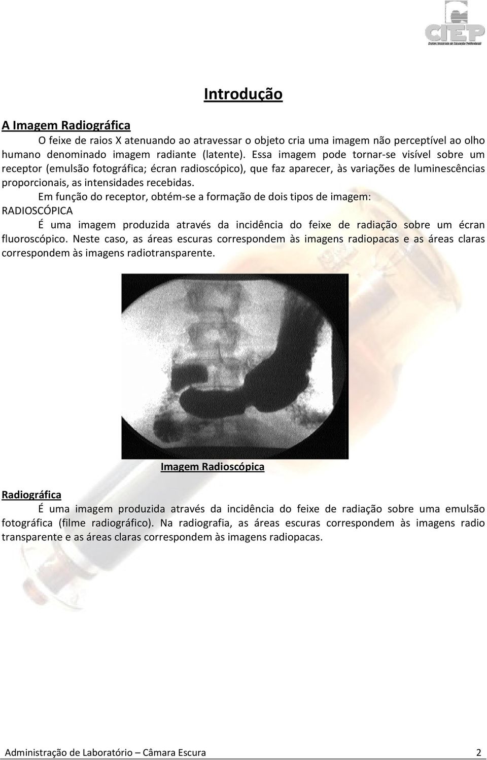 Em função do receptor, obtém-se a formação de dois tipos de imagem: RADIOSCÓPICA É uma imagem produzida através da incidência do feixe de radiação sobre um écran fluoroscópico.