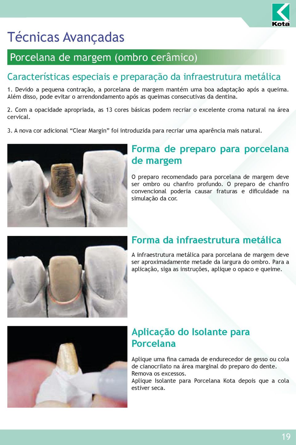 Com a opacidade apropriada, as 13 cores básicas podem recriar o excelente croma natural na área cervical. 3. A nova cor adicional Clear Margin foi introduzida para recriar uma aparência mais natural.