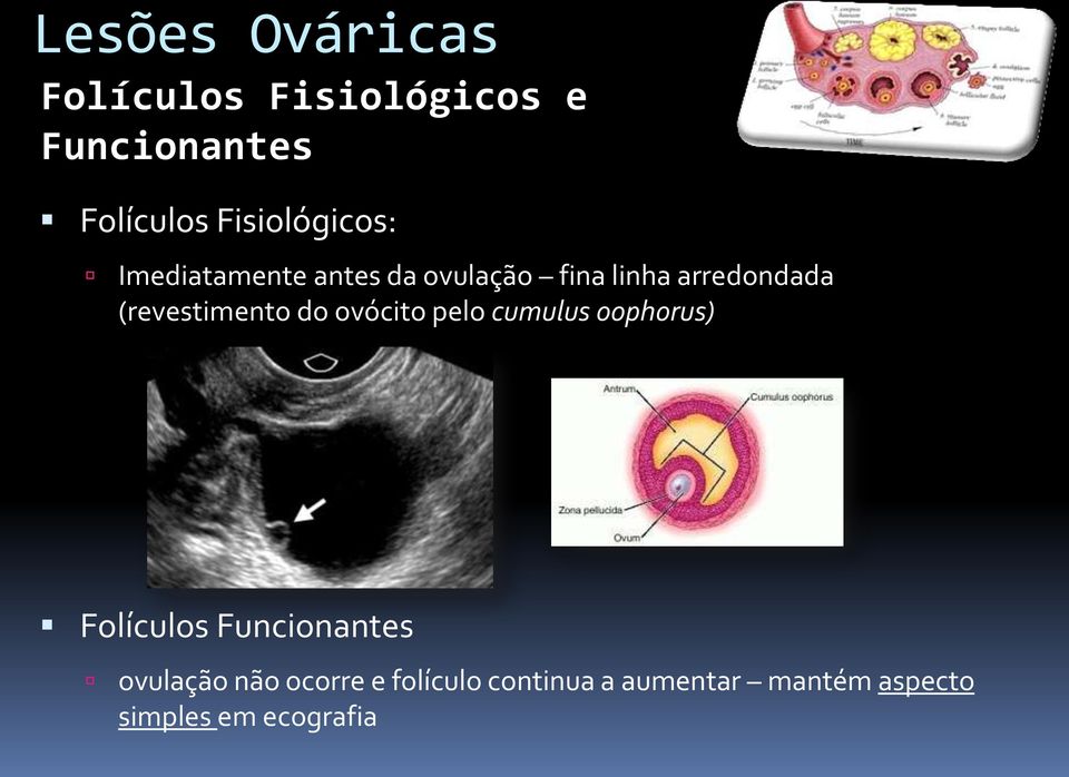 (revestimento do ovócito pelo cumulus oophorus) Folículos Funcionantes