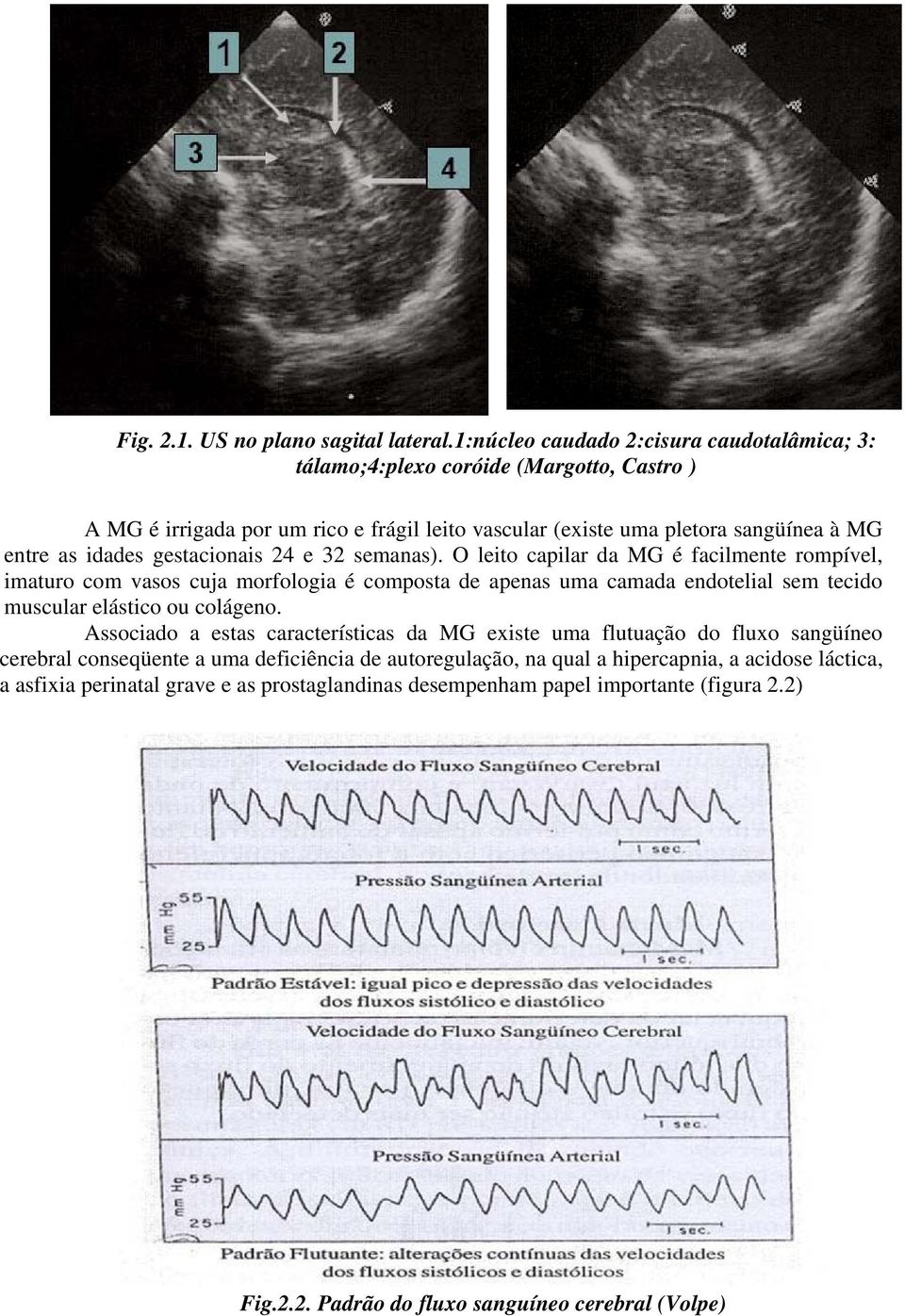 idades gestacionais 24 e 32 semanas).