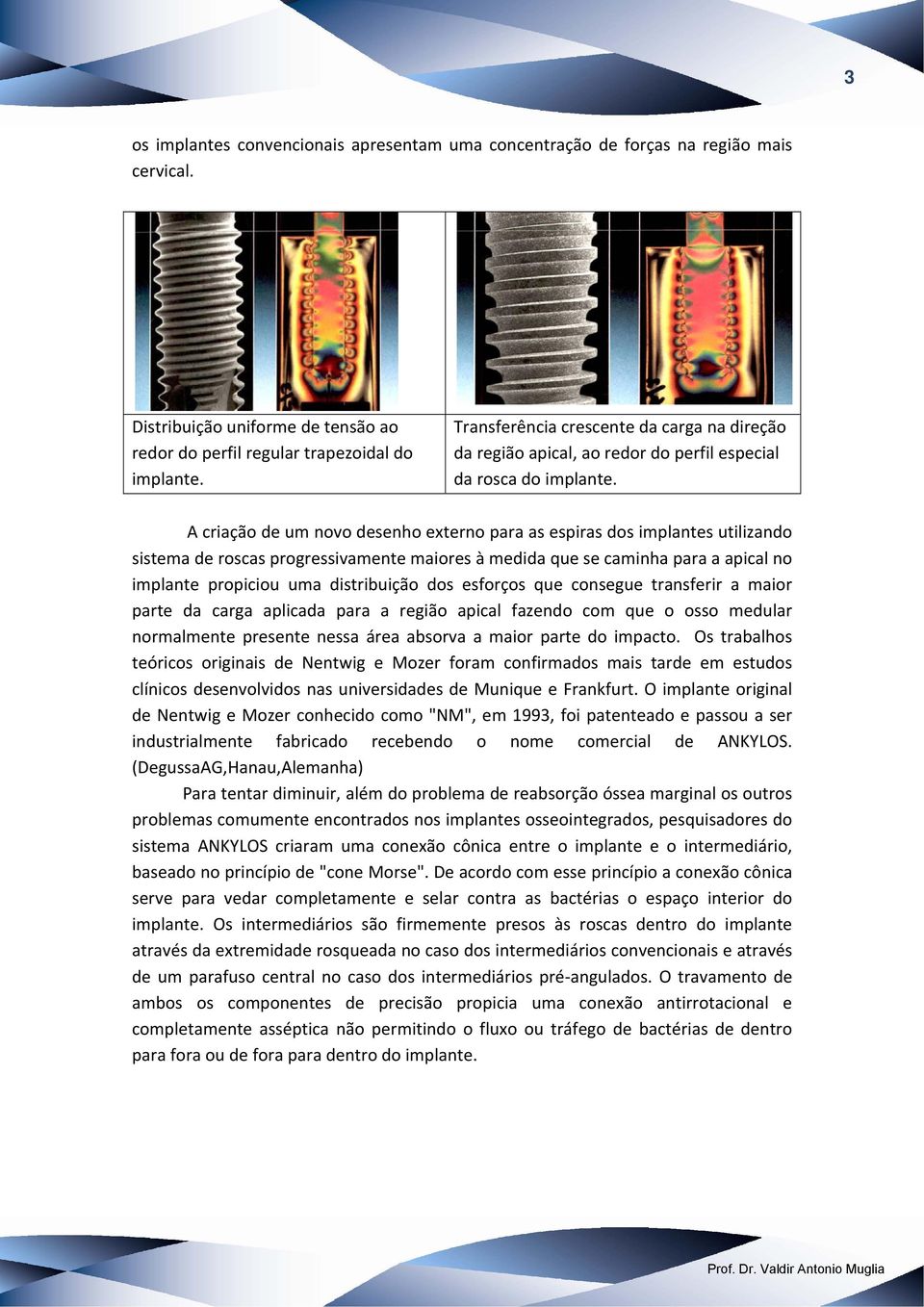 A criação de um novo desenho externo para as espiras dos implantes utilizando sistema de roscas progressivamente maiores à medida que se caminha para a apical no implante propiciou uma distribuição