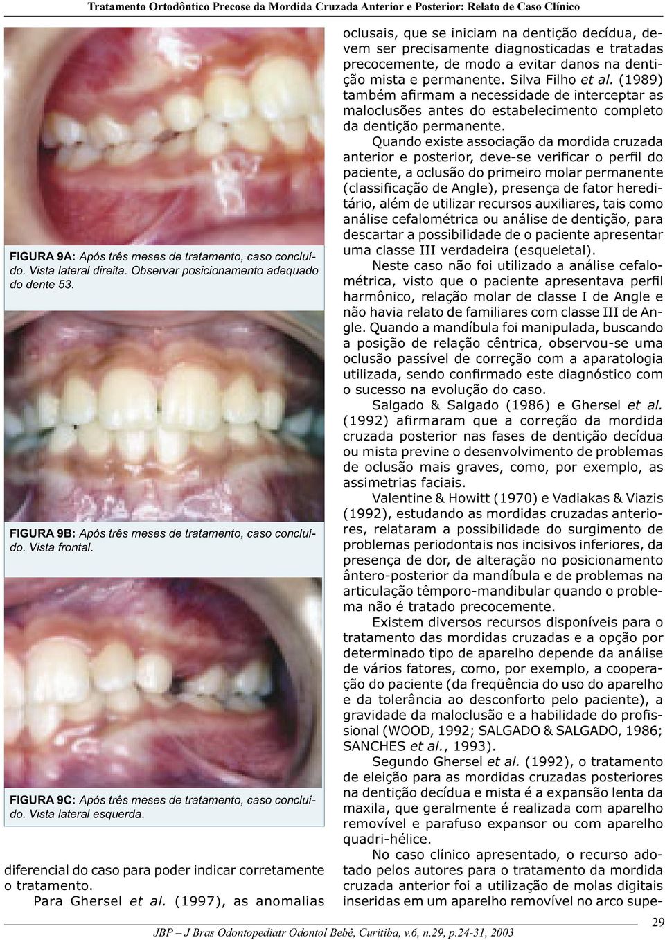 diferencial do caso para poder indicar corretamente o tratamento. Para Ghersel et al.