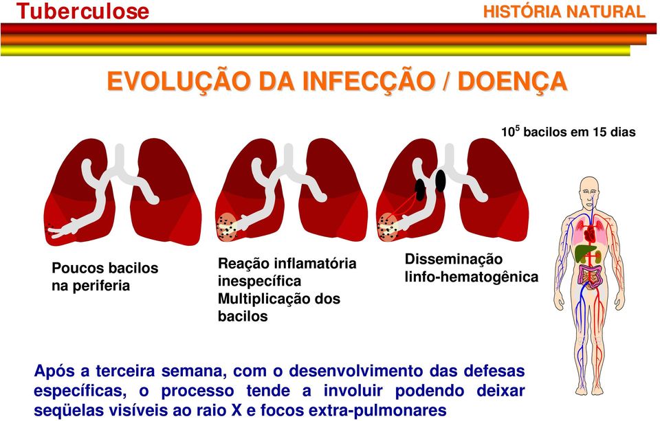 linfo-hematogênica Após a terceira semana, com o desenvolvimento das defesas