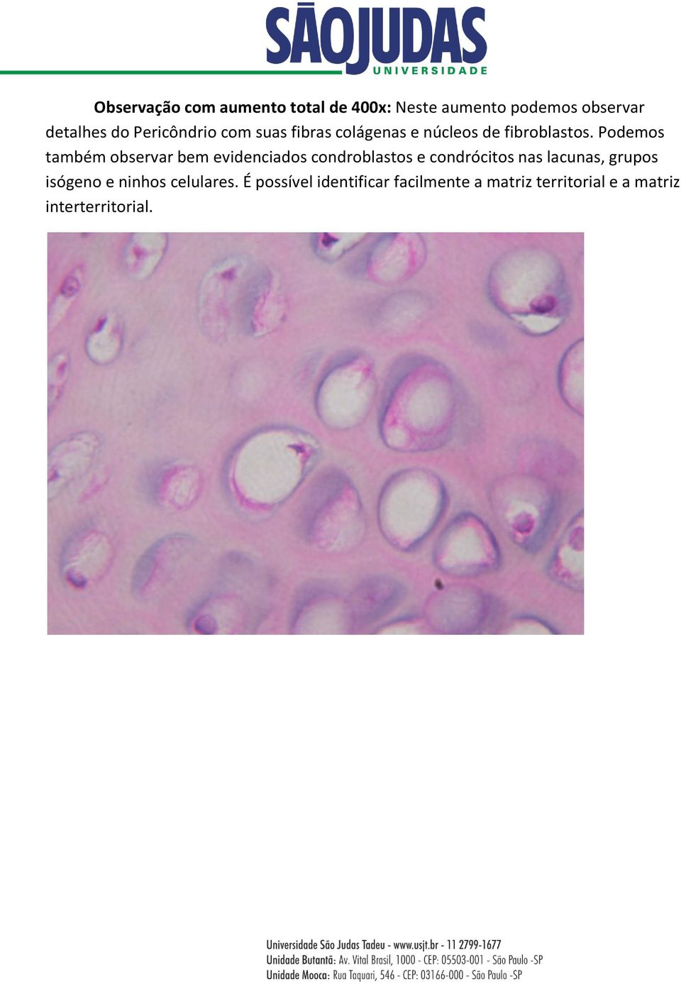 Podemos também observar bem evidenciados condroblastos e condrócitos nas lacunas,
