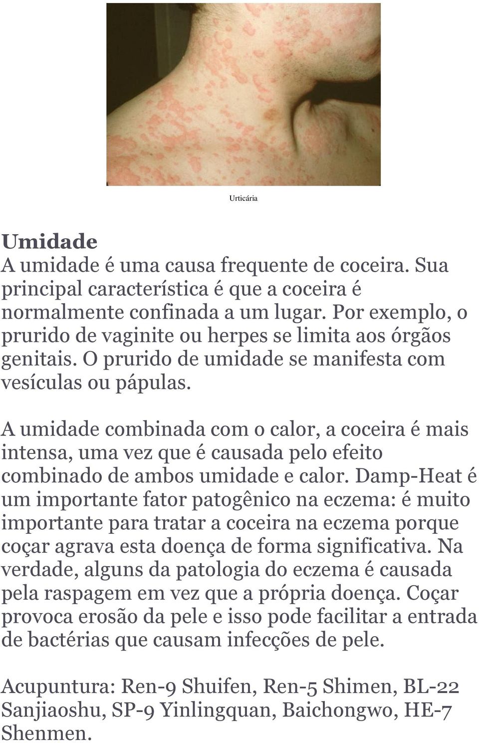 A umidade combinada com o calor, a coceira é mais intensa, uma vez que é causada pelo efeito combinado de ambos umidade e calor.