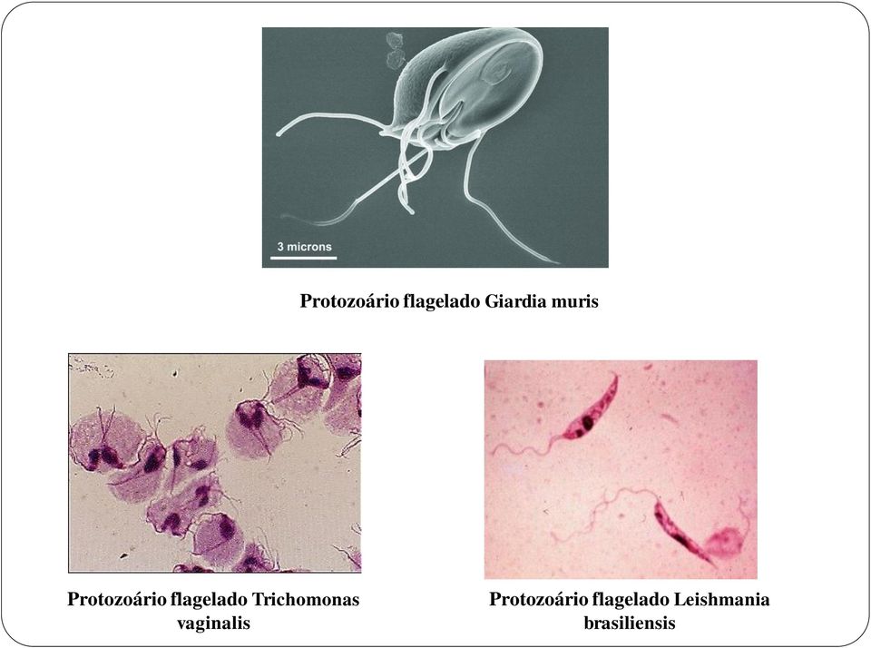 Trichomonas vaginalis