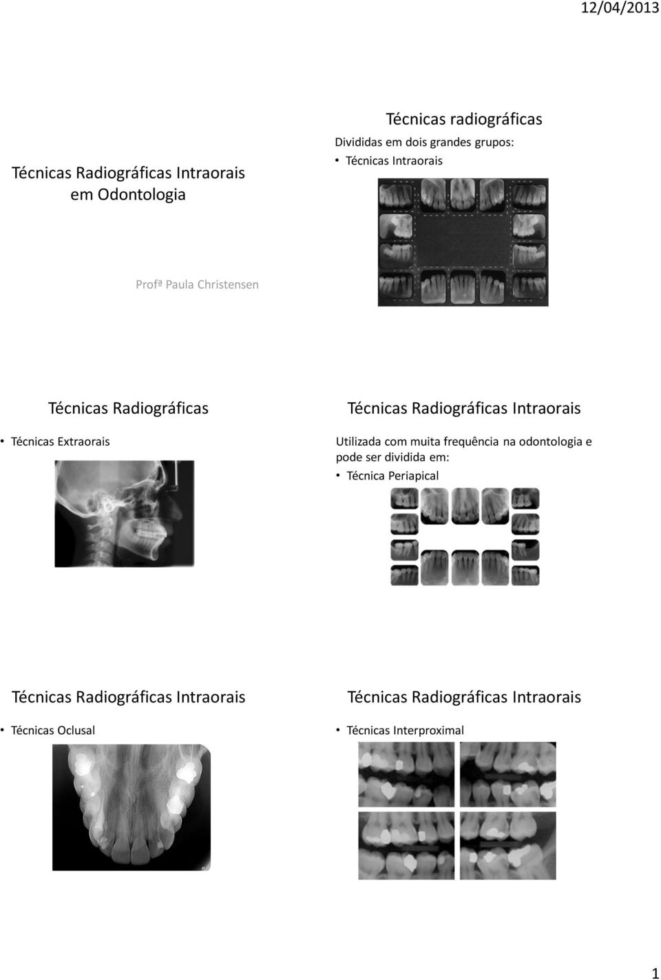Técnicas Radiográficas Intraorais Utilizada com muita frequência na odontologia e pode ser dividida