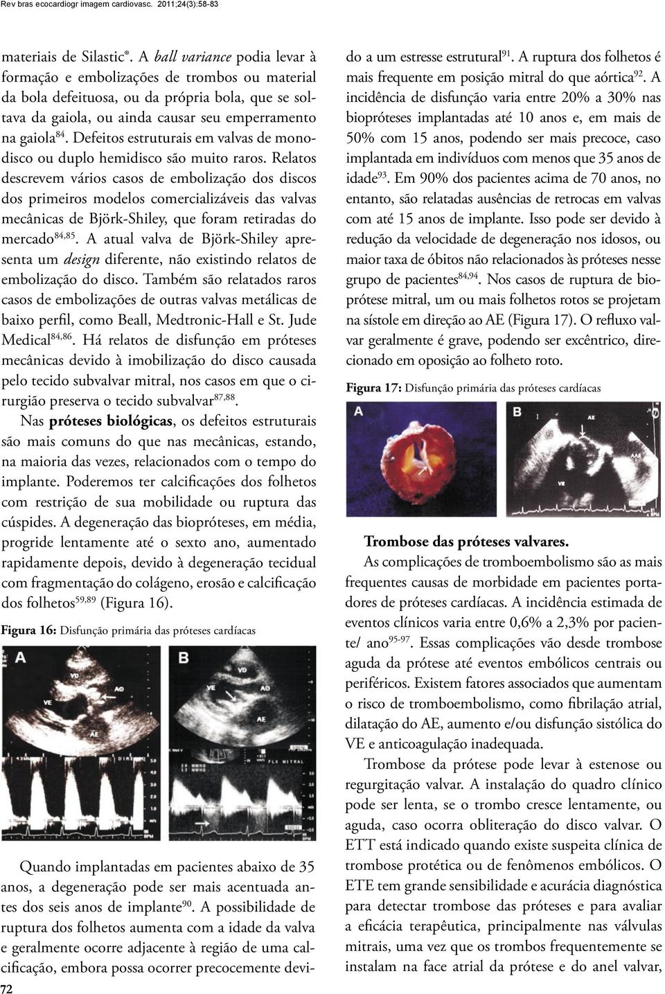 Defeitos estruturais em valvas de monodisco ou duplo hemidisco são muito raros.