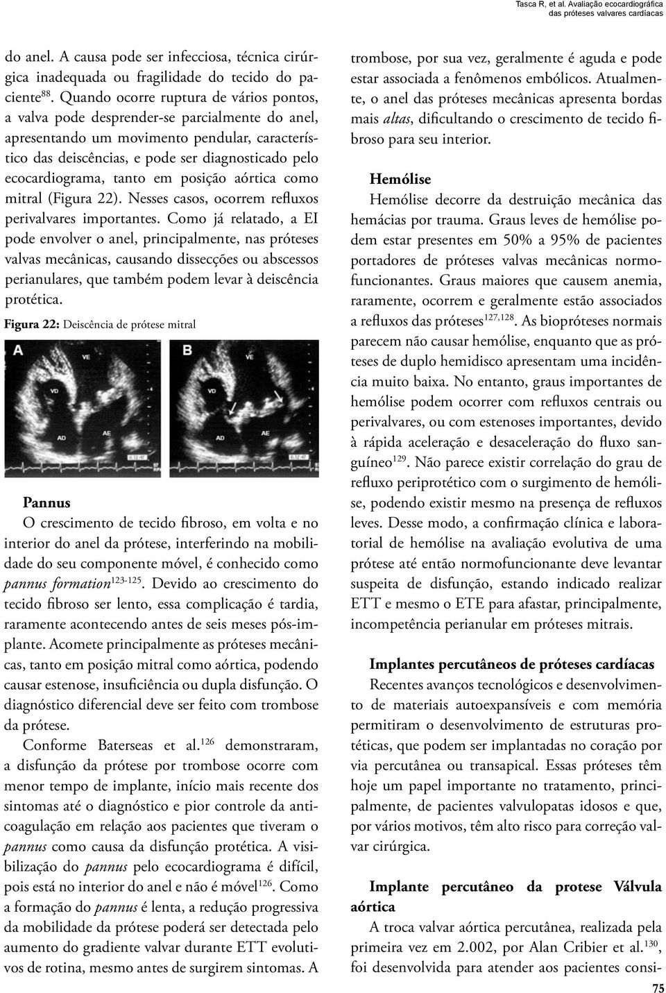 ecocardiograma, tanto em posição aórtica como mitral (Figura 22). Nesses casos, ocorrem refluxos perivalvares importantes.